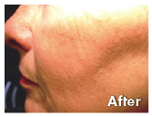 A Youthful Appearance …at any age