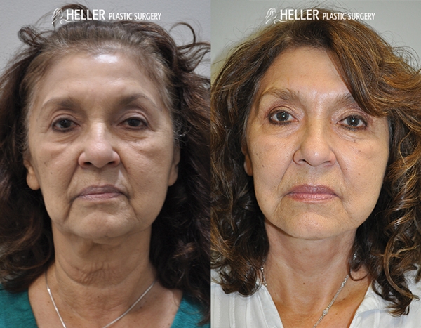Transformations – Aug/Sept 2018